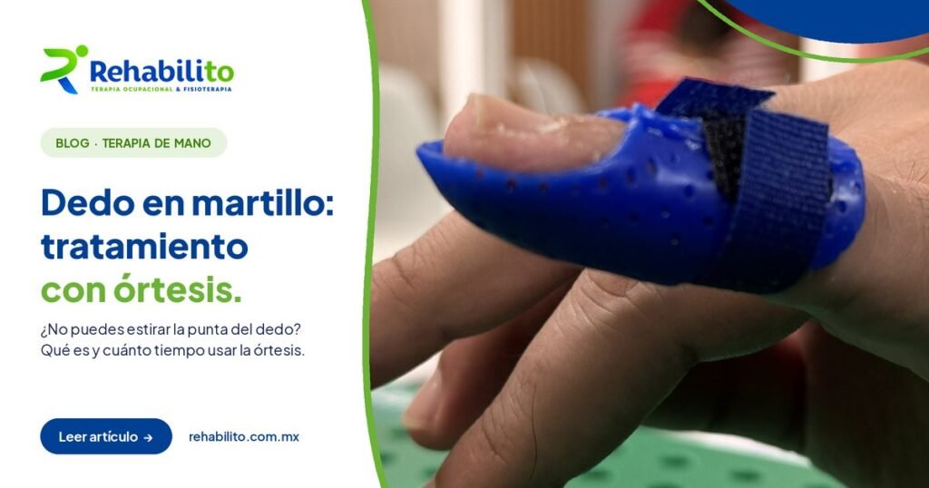 Portada del artículo dedo en martillo: tratamiento con órtesis, RehabiliTO