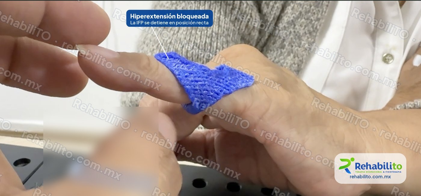 Órtesis en ocho para dedo en cuello de cisne
