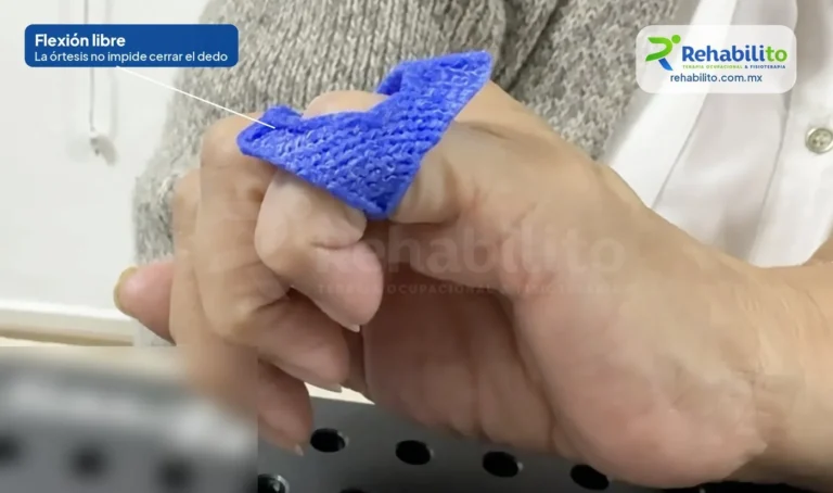 Órtesis en ocho. Dedo en cuello de cisne · bloquea la hiperextensión y deja doblar el dedo. RehabiliTO, CDMX