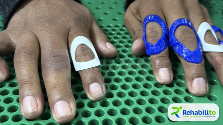 Anillos impresos en 3D. Órtesis tipo anillo para dedos. RehabiliTO, CDMX