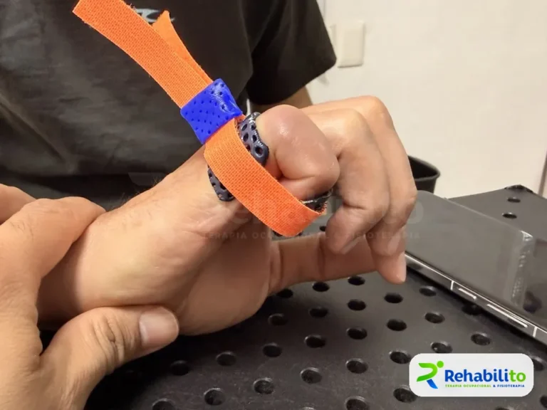Anillos impresos en 3D. Con correa de tracción para el dedo. RehabiliTO, CDMX