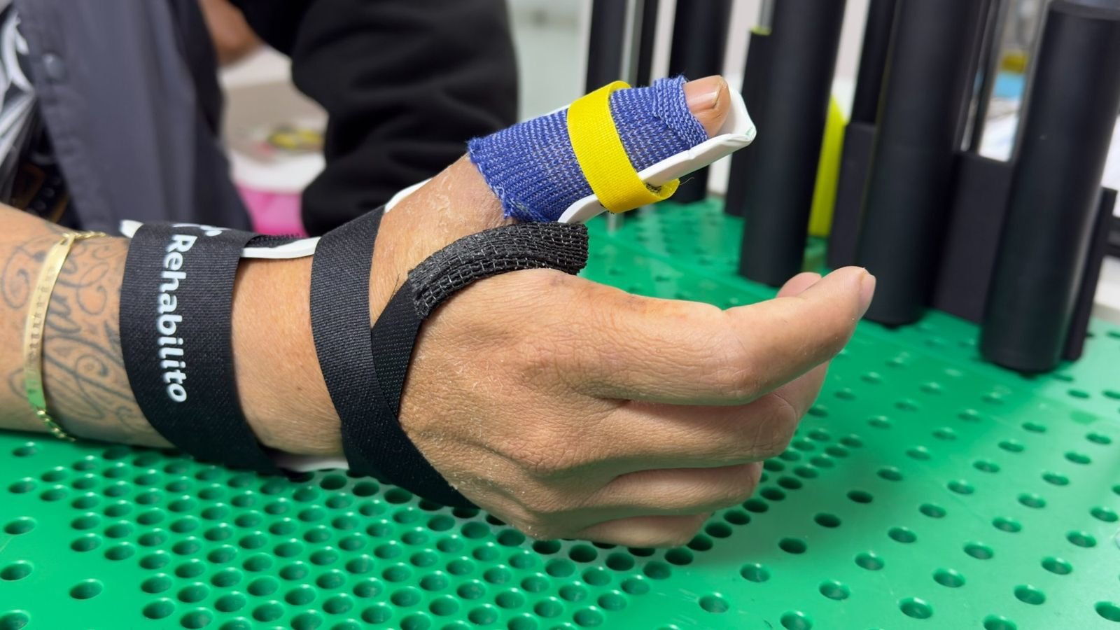 Órtesis de termoplástico para dedo con correas