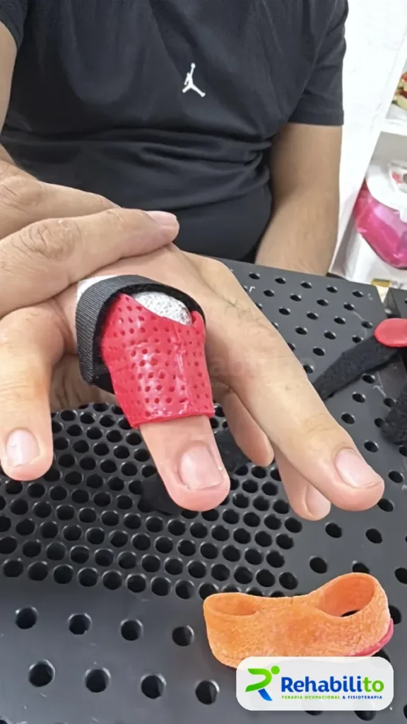 Órtesis de dedo con correa. Termoplástico rojo perforado. RehabiliTO, CDMX