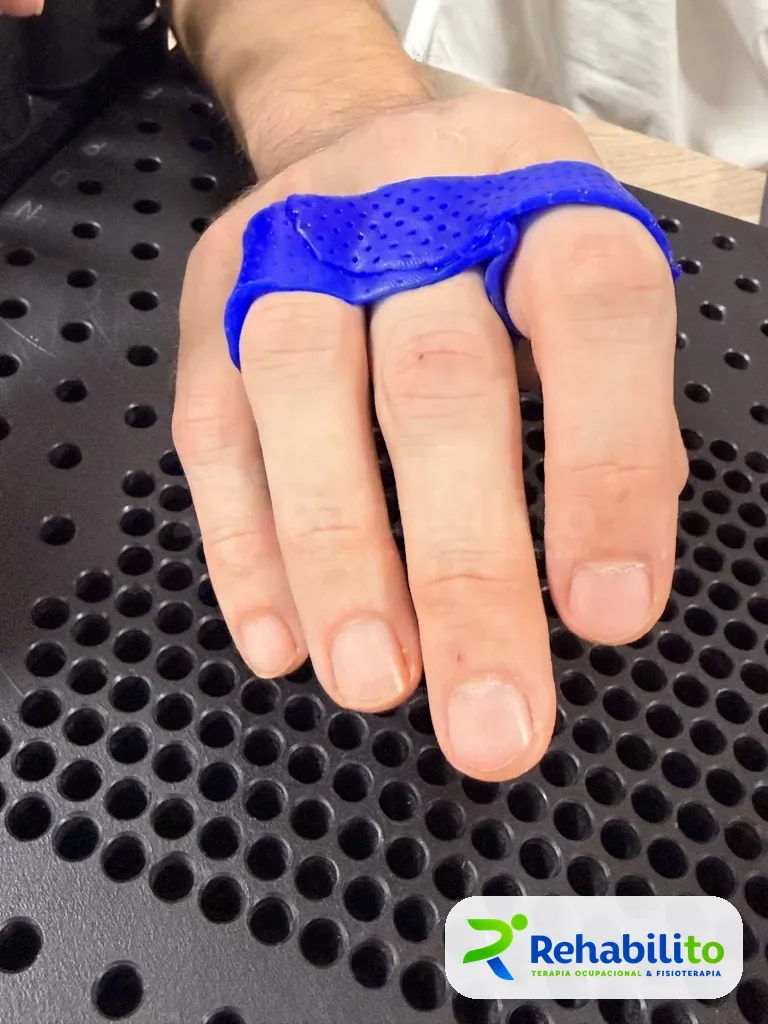 Órtesis para dedos a la medida. Termoplástico azul perforado. RehabiliTO, CDMX