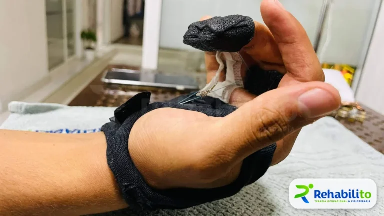 Órtesis dinámica de mano. Colocada en paciente. RehabiliTO, CDMX