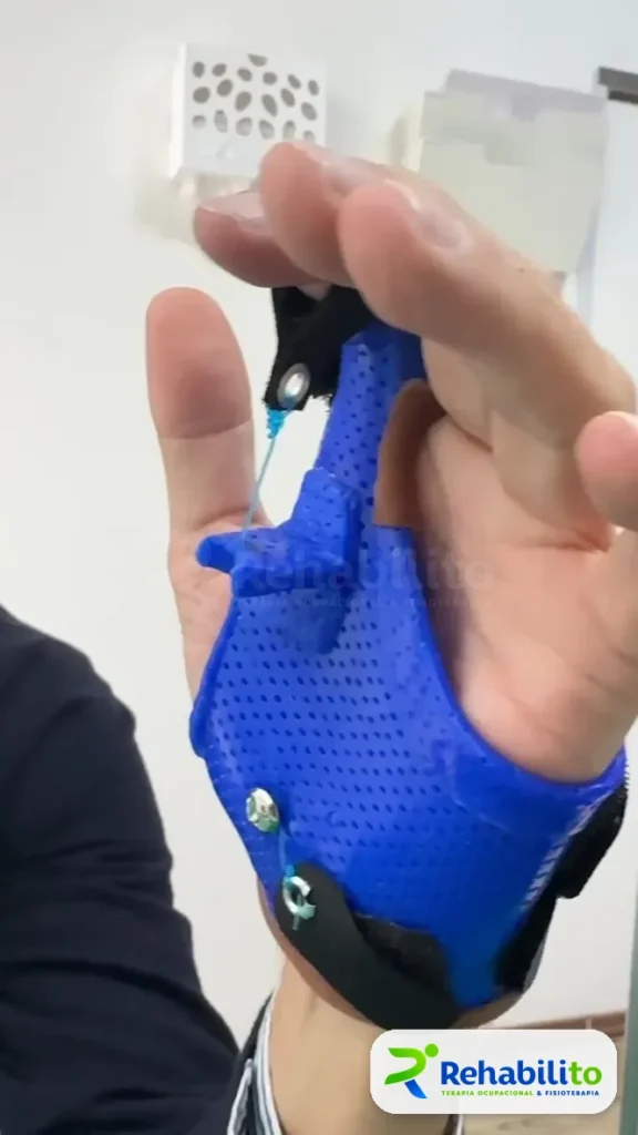 Órtesis dinámica de pulgar. Termoplástico azul con tracción. RehabiliTO, CDMX