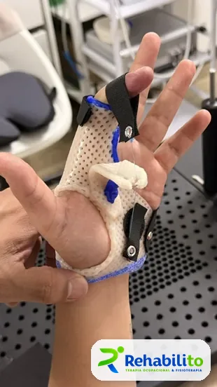 Órtesis dinámica de pulgar. Vista palmar. RehabiliTO, CDMX