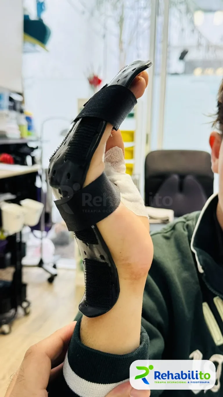 Órtesis tipo Saint John. Muñeca y pulgar. RehabiliTO, CDMX