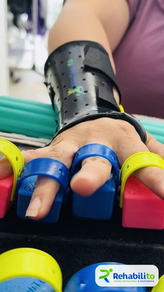 Órtesis para dedos. A la medida. RehabiliTO, CDMX