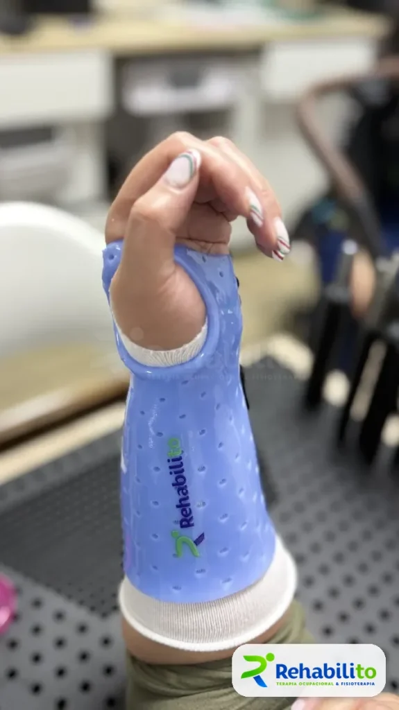 Órtesis de muñeca. Vista frontal. RehabiliTO, CDMX