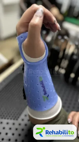 Órtesis de muñeca. Termoplástico azul con logo RehabiliTO. RehabiliTO, CDMX