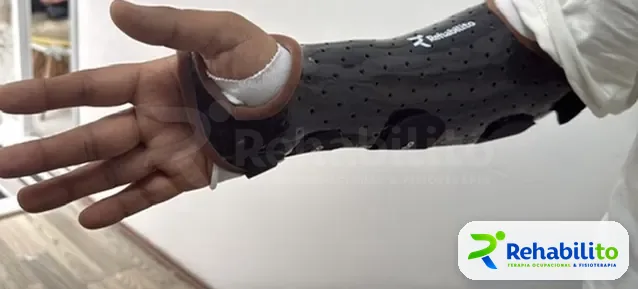 Órtesis de muñeca y pulgar. Termoplástico negro perforado. RehabiliTO, CDMX