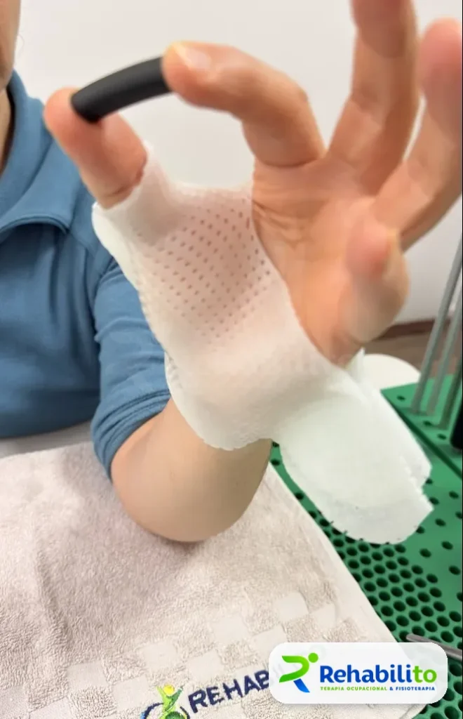 Órtesis de pulgar en pinza. Durante ejercicio funcional. RehabiliTO, CDMX