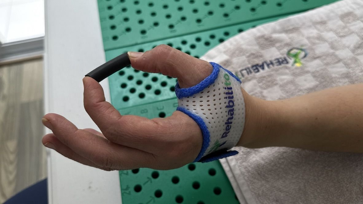 Órtesis corta de pulgar a la medida para rizartrosis durante un ejercicio de pinza en RehabiliTO