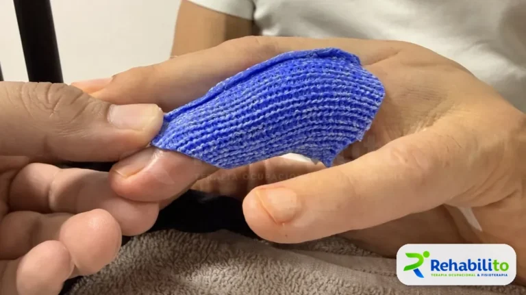 Órtesis de pulgar. Malla termoplástica azul. RehabiliTO, CDMX