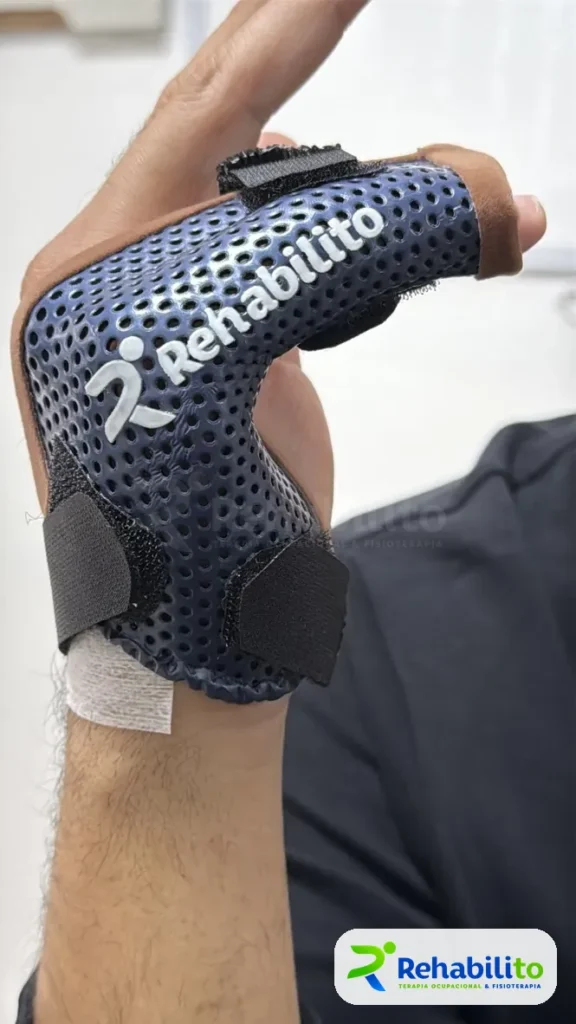 Órtesis de pulgar y muñeca. Termoplástico perforado a la medida. RehabiliTO, CDMX