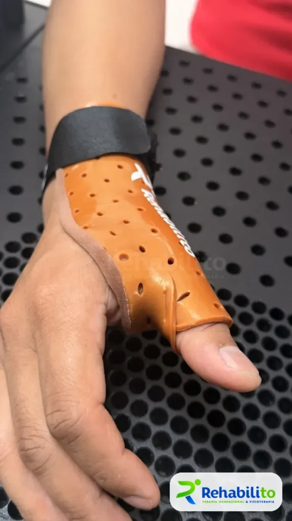 Órtesis de pulgar. Termoplástico naranja. RehabiliTO, CDMX