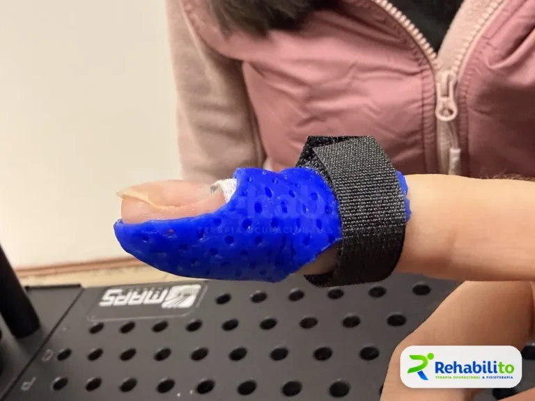 Órtesis de pulgar. Termoplástico azul perforado. RehabiliTO, CDMX