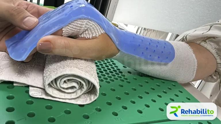 Moldeado de órtesis de reposo. Termoplástico azul sobre la mano. RehabiliTO, CDMX