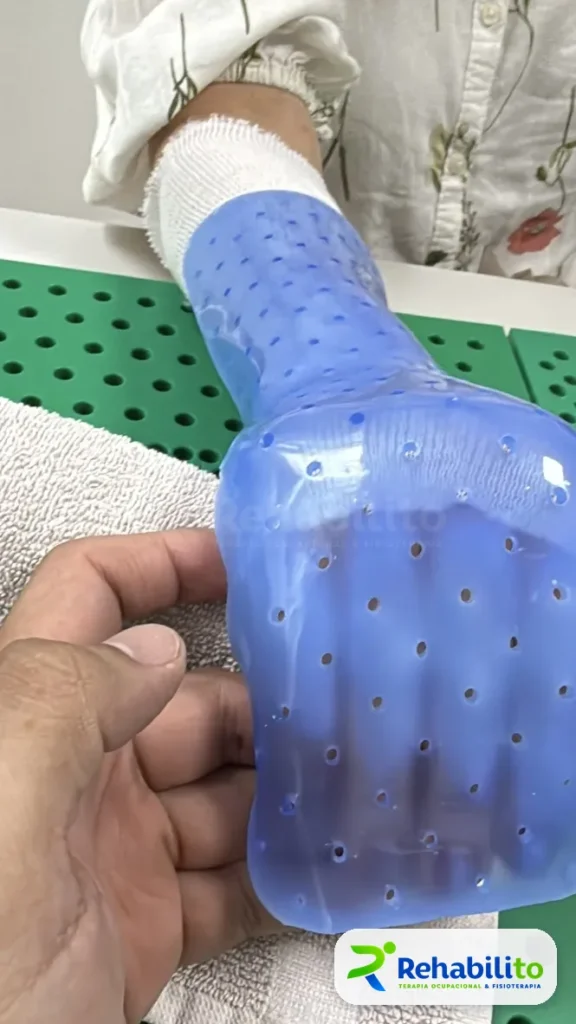 Órtesis de reposo palmar. Termoplástico azul perforado. RehabiliTO, CDMX