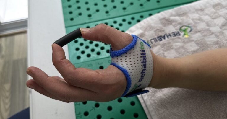 Paciente con órtesis de pulgar en ejercicio de pinza